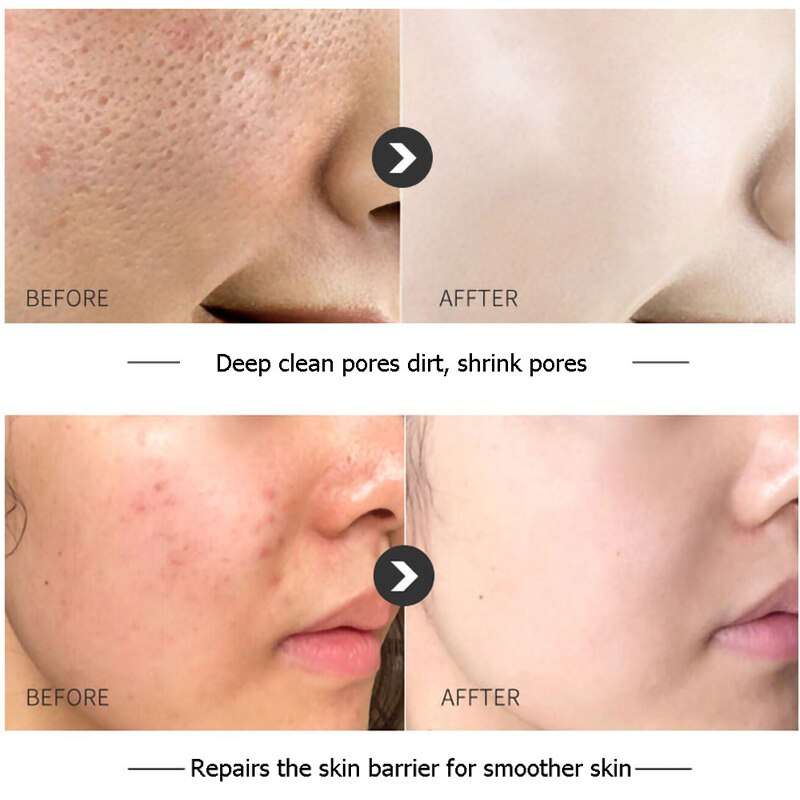 Facial Cleanser Green Tea Facial Cleanser Green Tea typesshop1
