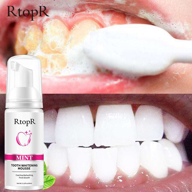 Teeth Whitening Mousse Teeth Whitening Mousse Health and Care - 10p