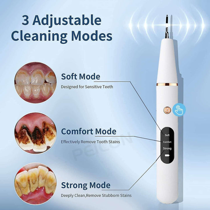 Ultrasonic Dental Scaler HEALTH & BEAUTY Ultrasonic Dental Scaler