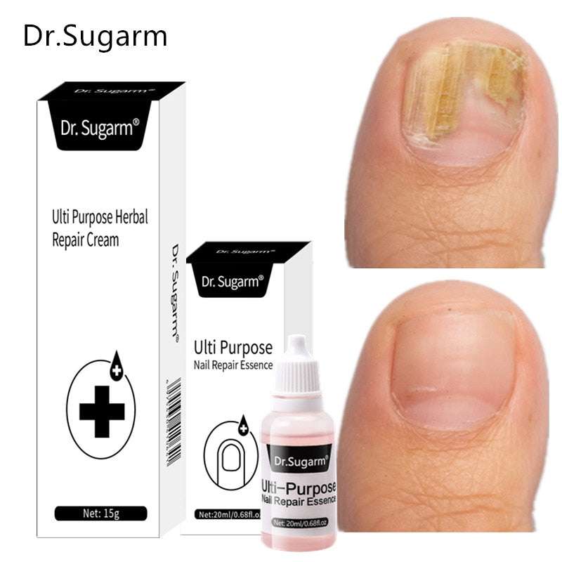 Dr.Sugarm Strong Nail Fungus Treatment Serum - Gifting By Julia M