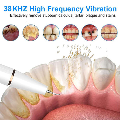 Ultrasonic Dental Scaler - Gifting By Julia M